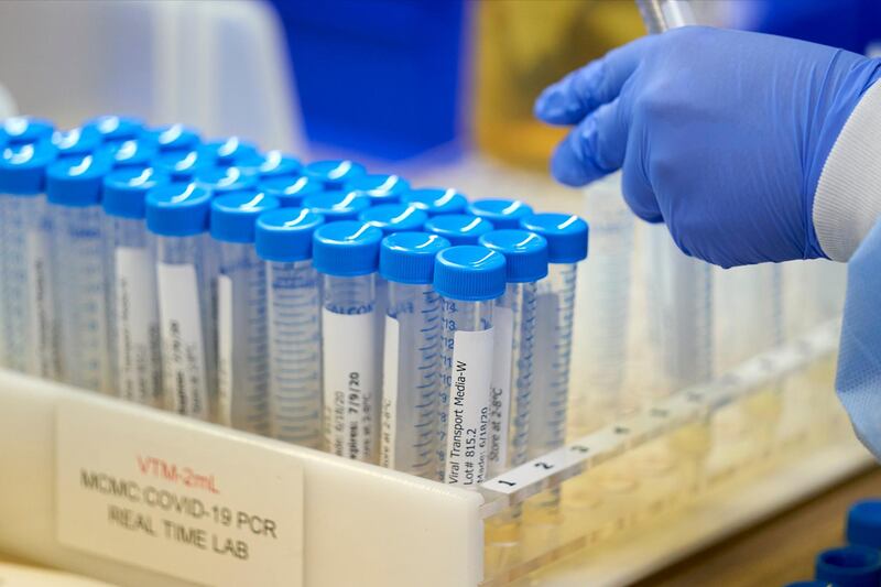 A lab at Methodist Dallas Medical Centre prepares viral transport media for samples before collecting samples for coronavirus in Dallas, Texas. Reuters