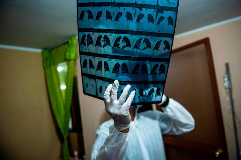 A doctor checks an X-ray of a Covid-19 patient in a house on the eastern outskirts of Lima. AFP