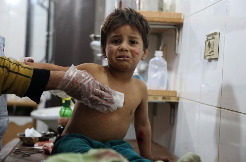 Syrian Mohammed cries as he receives treatment at a make-shift hospital in Kafr Batna after being wounded with his mother in government air strikes on the town of Jisreen, in the besieged Eastern Ghouta region on the outskirts of the capital Damascus, on February 19, 2018.  Ammar Suleiman / AFP