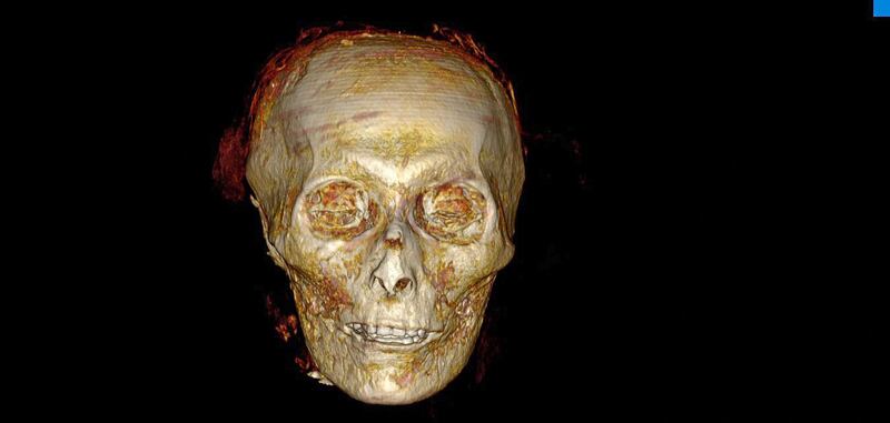 A 3D reconstruction of the head of Amenhotep I created using computed tomography scans. By 'digitally unwrapping' the mummy, scientists for the first time since it was discovered in 1881 revealed its secrets without disturbing the funerary mask. AFP