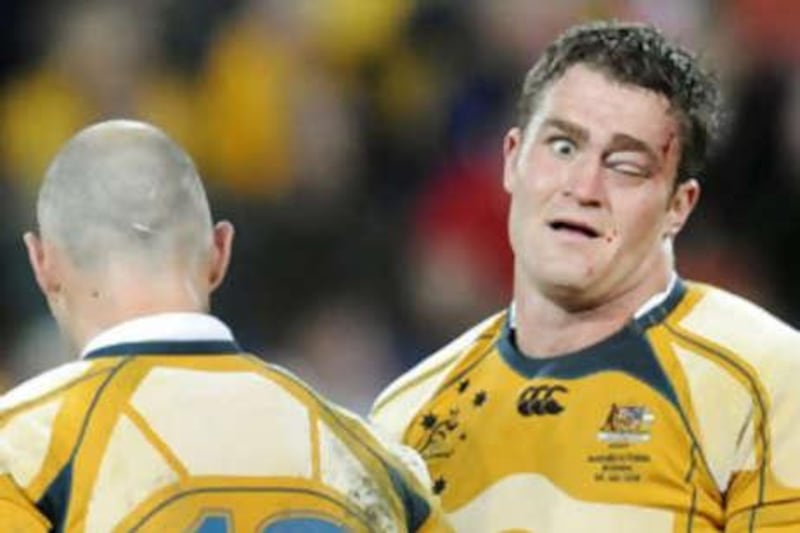 The Australian James Horwill has his eye closed after clashing with the French forwards.