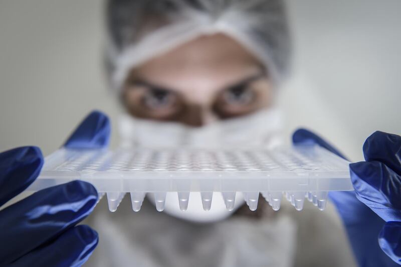 A lab technician holds a PCR plate to perform Covid-19 tests at Hermes Pardini Lab amid the pandemic in Vespasiano, Brazil. Getty Images