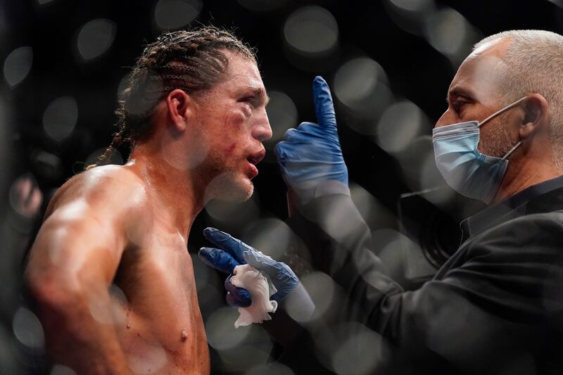 Brian Ortega is checked by his trainer during a break between rounds. AP Photo