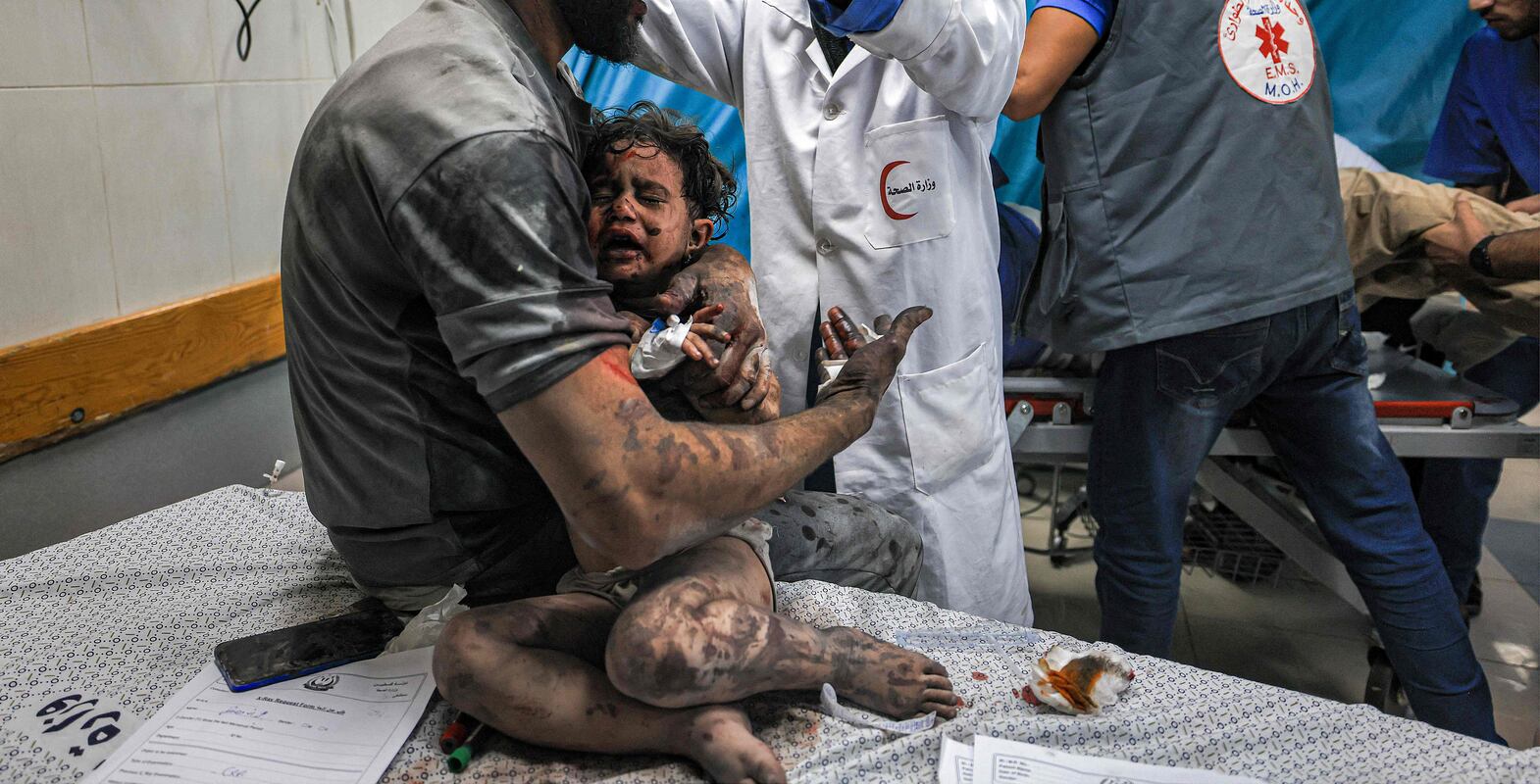 EDITORS NOTE: Graphic content / A man holds a child, survivors of Israeli bombardment, as they are treated at a trauma ward at Nasser hospital in Khan Yunis in the southern Gaza Strip on October 24, 2023 amid the ongoing battles between Israel and the Palestinian group Hamas.  Thousands of civilians, both Palestinians and Israelis, have died since October 7, 2023, after Palestinian Hamas militants based in the Gaza Strip entered southern Israel in an unprecedented attack triggering a war declared by Israel on Hamas with retaliatory bombings on Gaza.  (Photo by Mahmud HAMS  /  AFP)