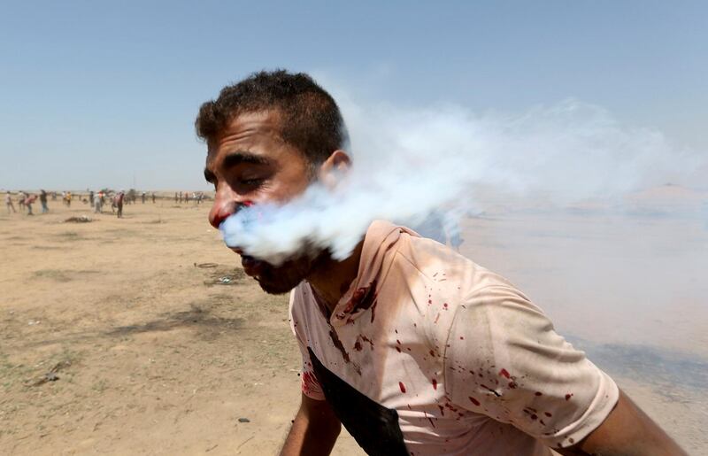 ATTENTION EDITORS - VISUAL COVERAGE OF SCENES OF INJURY OR DEATH A wounded Palestinian demonstrator, Haitham Abu Sabla, 23, is hit in the face with a tear gas canister fired by Israeli troops during a protest marking al-Quds Day, (Jerusalem Day), at the Israel-Gaza border in the southern Gaza Strip June 8, 2018. REUTERS/Ibraheem Abu Mustafa   SEARCH "GAZA FACE" FOR THIS STORY. SEARCH "WIDER IMAGE" FOR ALL STORIES.  TPX IMAGES OF THE DAY.  TEMPLATE OUT