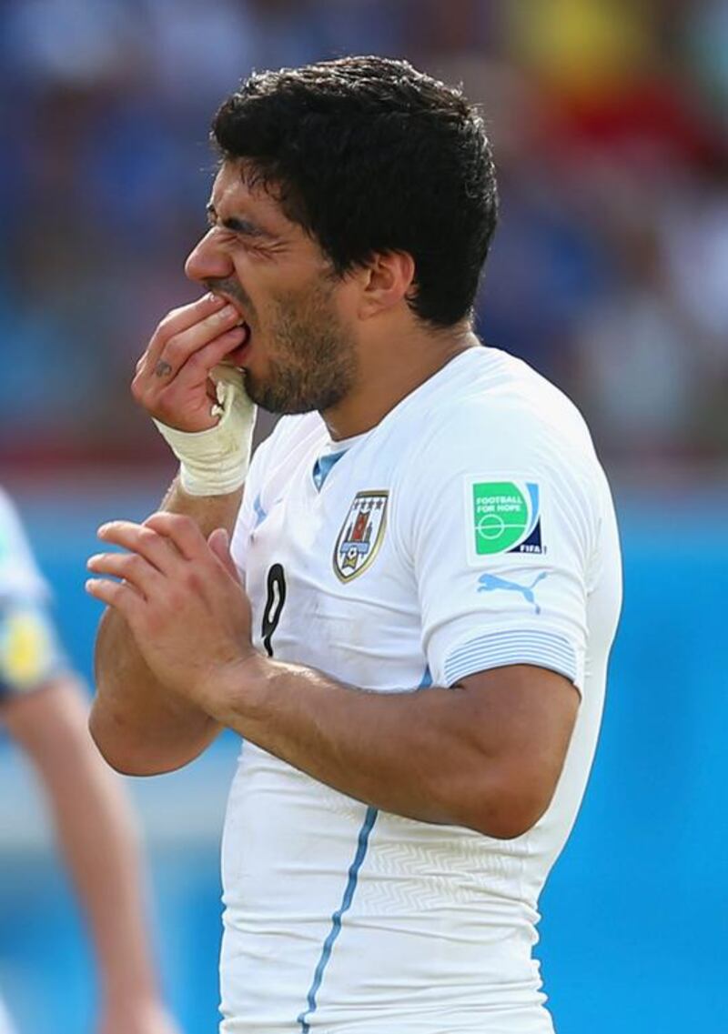 Luis Suarez of Uruguay grabs his teeth after appearing to bring his head down on Giorgio Chiellini's shoulder during a corner in their match on Tuesday at the 2014 World Cup. Clive Rose / Getty Images  