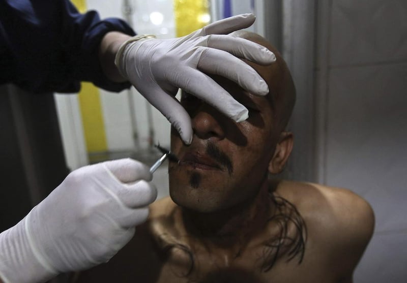 A drug addict is shaved after taking a cold shower as part of his treatment. Omar Sobhani / Reuters