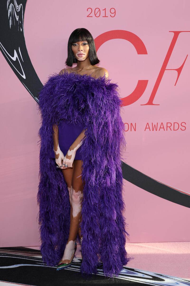 Winnie Harlow arrives for the 2019 CFDA fashion awards at the Brooklyn Museum in New York City on June 3, 2019. Reuters