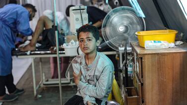 An injured Palestinian boy awaits treatment at the Kuwaiti hospital following Israeli strikes in Rafah in the southern Gaza Strip. AFP