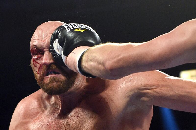 Tyson Fury is punched during his heavyweight bout against Otto Wallin. AFP