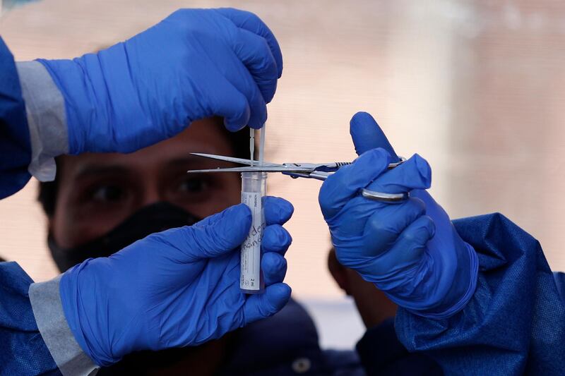 A patient looks on as their nasal and throat swabs are put into a test tube, during walk-up Covid-19 testing in a mobile diagnostic tent in San Gregorio Atlapulco in the Xochimilco district of Mexico City. AP Photo