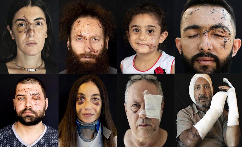 August 20 Big Pic Photos of the Beirut port blast survivor: (L-R Top) Angelique Sabounjian was at work when the explosion rocked the city, Shady Rizk, 32, a network engineer, was injured at his office, Yara Saeid, 4, was at her parents’ apartment, Hussein Haidar, 27, was working at his office.
(L-R Bottom) Hassan Nabha, 27, a computer and communication engineer, was at his office, Clara Chammas, a psychologist and a health coach, was injured at her apartment, Tony Helou, 63, unemployed, was injured at his apartment and Rainier Jreissati, 63, a businessman, was at home when the blast struck.   AP