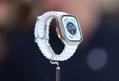 Patients tasking part in the trial will use an Apple Watch and iPhone app to monitor the affects of blood thinners. AFP