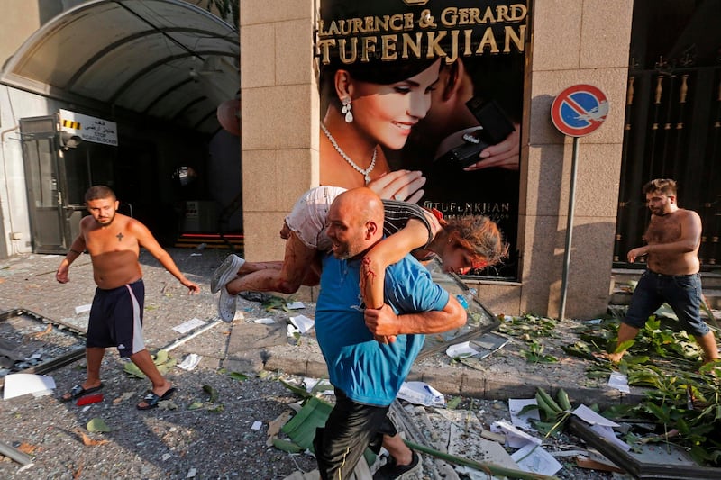 A man carries an injured girl while walking through debris in the Achrafiyeh district in Lebanon's capital Beirut. AFP