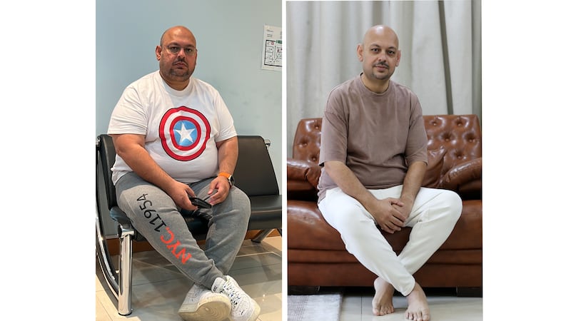 Sarosh Sohail lost 72kg after using the obesity drug Mounjaro for a year. Shahar Bano / Chris Whiteoak / The National