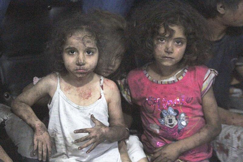Injured children rest in a field hospital, after what activists claim were two air strikes by forces loyal to Syria's president Bashar Al Assad, in rebel-held Douma, near Damascus, on September 14. Badra Mamet / Reuters
