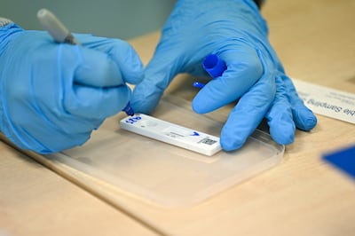 Lateral flow tests are a quick and easy alternative to PCR tests and can be done at home. AFP