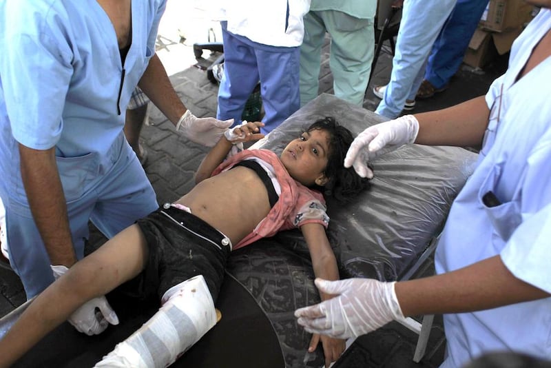 A Palestinian girl receives medical care at the hospital in Rafah, in the southern Gaza Strip after she was wounded in an Israeli military strike on August 2, 2014. At least 296 Palestinian children and adolescents have been killed since Israel launched its offensive in the Gaza Strip against Hamas on July 8, the UN children's agency UNICEF said. AFP Photo.

