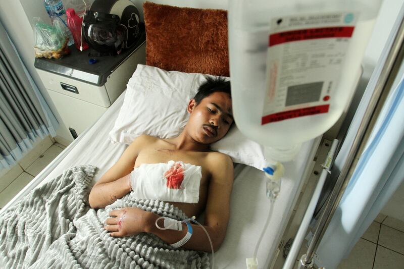 A victim of the eruption of Mount Merapi receives medical treatment at the city regional general hospital in Padang Panjang, West Sumatra province. Reuters