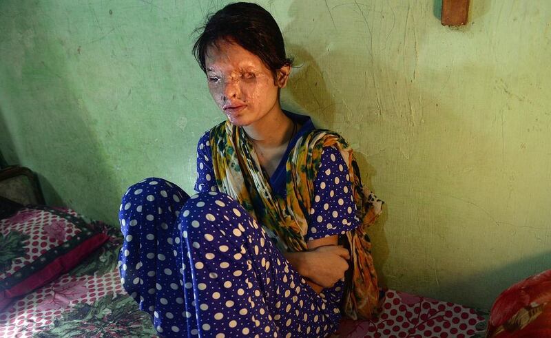 Indian acid attack survivor Reshma Qurashi rests in her home at a slum in the eastern suburbs of Mumbai. The Indian teenager’s voice trembles as she recalls the day she lost her face. Indranil Mukherjee/AFP Photo