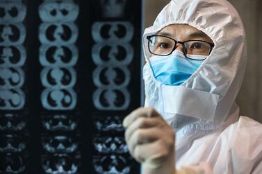 A doctor looks at a lung CT image at a hospital in Yunmeng county, Xiaogan city, in China's central Hubei province. AFP