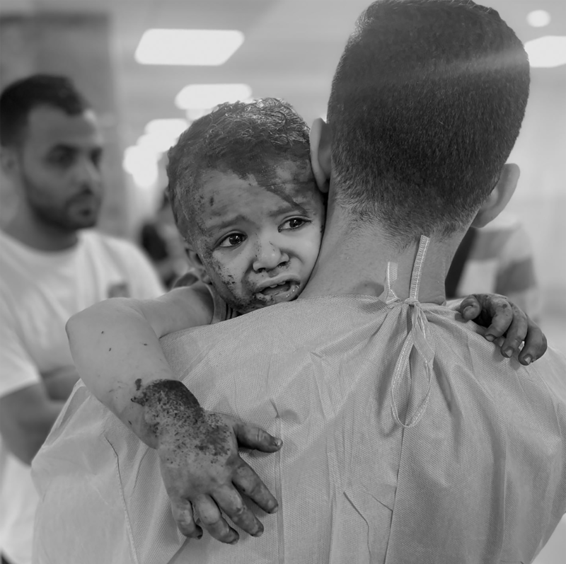 A young child awaits medical treatment. Photo: Abed Elhakeem Abo Riash