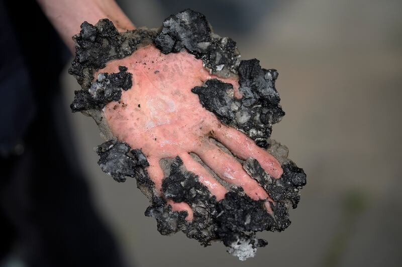 A climate activist shows his hand, covered with asphalt, after police removed it from a road in Berlin with a hammer and chisel. AP