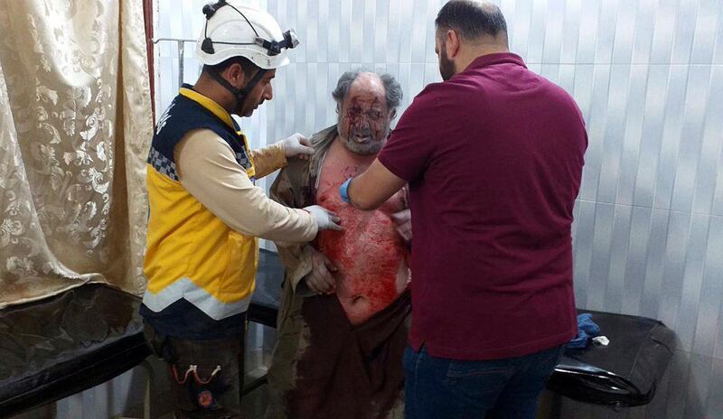 A man who was injured in attack on a market receiving treatment at a hospital, in the village of Ras el-Ain, in the northwestern province of Idlib, Syria. Syrian Civil Defense White Helmets via AP
