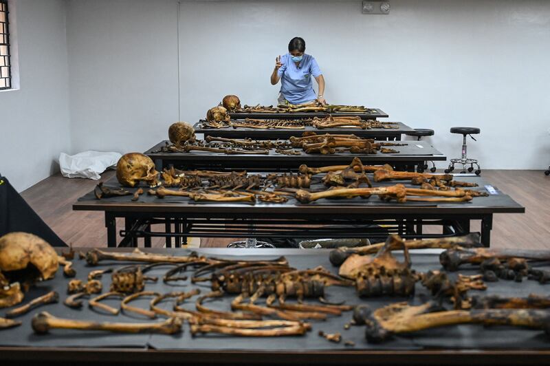 Forensic pathologist Raquel Fortun arranges the skeletal remains of a drugs war victim for autopsy in her laboratory in Manila. AFP