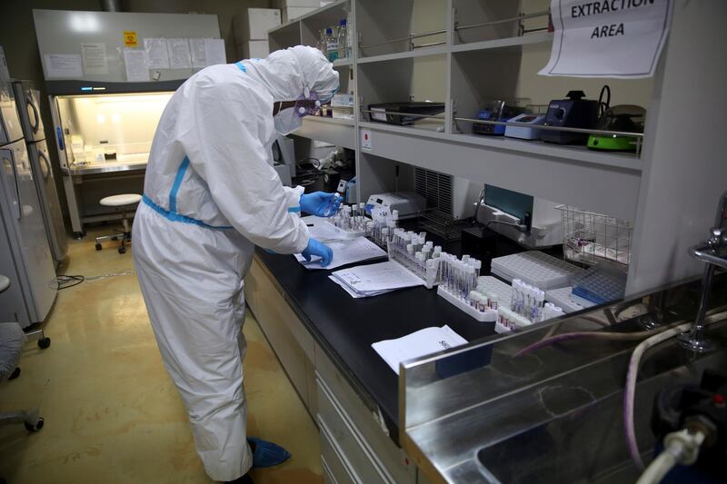 An Afghan lab technician tests samples at the Afghan-Japan Communicable Disease Hospital.
