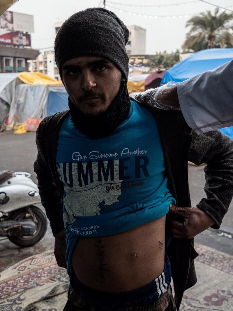 A protestor poses with a two-month-old bullet wound. The metal stitches are still clearly visible on both the entry and exit wounds - the handy work of Dr Al Abadi. Luke Pierce for The National