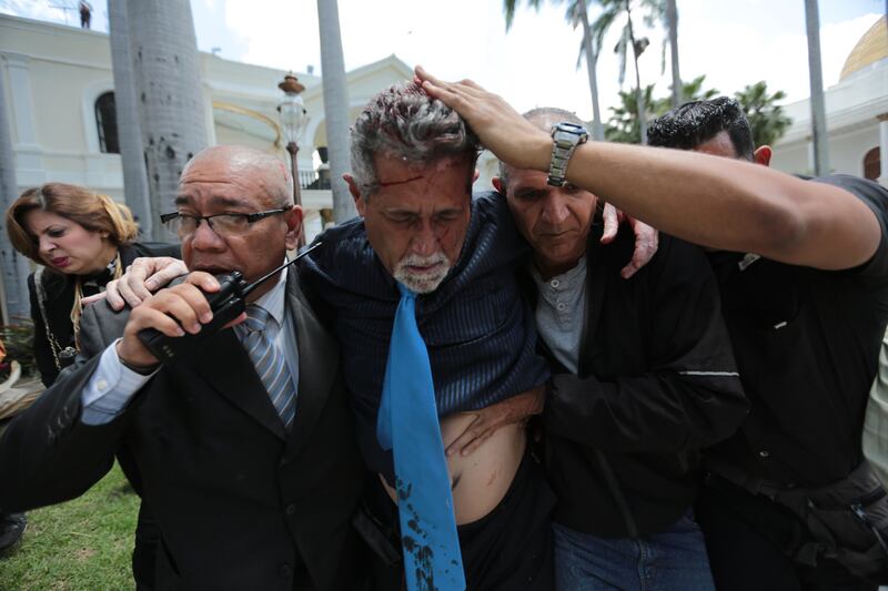 Opposition lawmaker Americo De Grazia is led away by bodyguards and a National Assembly employee after he was injured in a melee with supposed government supporters who tried to force their way into the National Assembly during a special session coinciding with Venezuela’s independence day, in Caracas, Wednesday, July 5, 2017. At least five lawmakers were injured in the attack. De Grazia had to be taken in a stretcher to an ambulance suffering from convulsions, said a fellow lawmaker. (AP Photos/Fernando Llano)
