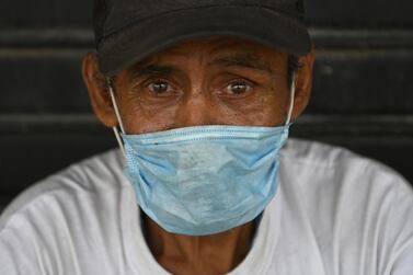 A homeless man wears a protective mask against the spread of the new coronavirus. AFP