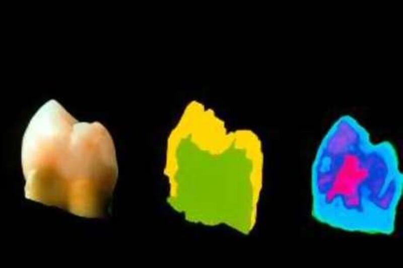 Terahertz images of tooth with an internal cavity