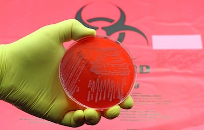 New discoveries like Zosurabalpin and murepavadin are part of a multi-pronged attack on antibiotic resistance. Getty Images