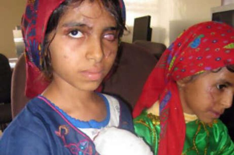 Athba Qasim al Sumaki, left, and Hana Qasim al Sumaki were injured in a landmine explosion that killed a third girl.