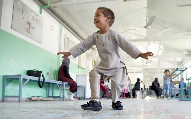 Ahmad Sayed Rahman, a five-year-old Afghan boy who lost his right leg when he was hit by a bullet in the crossfire of a battle, dances with his prosthetic leg at the International Committee of the Red Cross (ICRC) hospital for war victims and the disabled, in Kabul on May 7, 2019. - With his hands in the air and an infectious grin spreading from ear to ear, a young Afghan boy whirls around a Kabul hospital room on his new prosthetic leg. The boy, five-year-old Ahmad Sayed Rahman, has become a social media star in Afghanistan and beyond after a short video of him effortlessly dancing on his new limb was published this week on Twitter. (Photo by WAKIL KOHSAR / AFP)