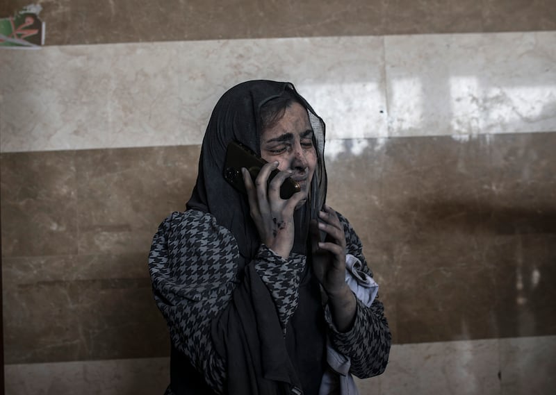An injured woman on the phone at Nasser Hospital in Khan Younis. EPA