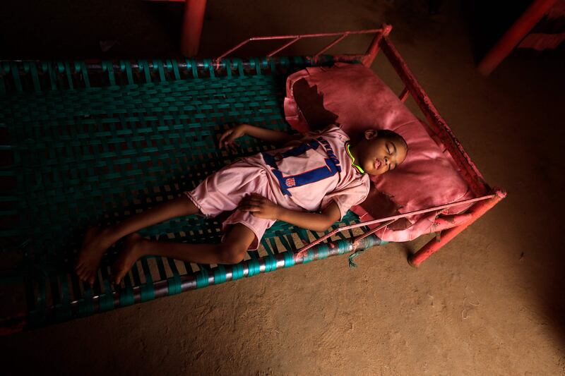 The four-year-old son of Awadya Ahmed, born blind and crippled, a handicap that she blames on a large mound of gold mining waste left near her house in Banat. AFP