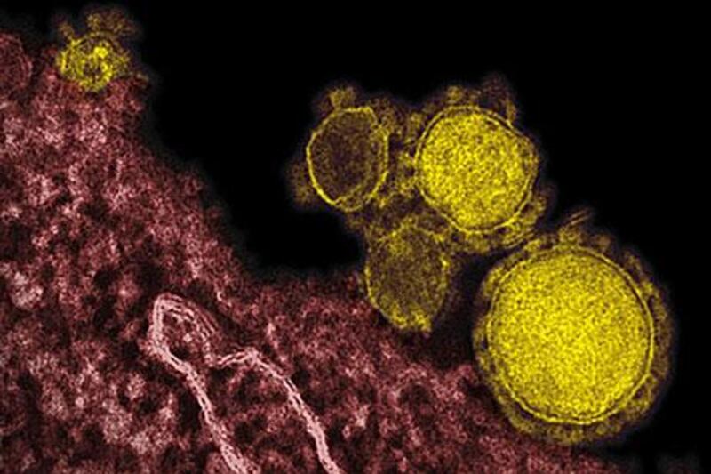 The mysterious new respiratory virus that originated in the Middle East spreads easily between people and appears more deadly than Sars, doctors say. RML / AP Photo
