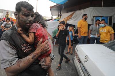 A wounded Palestinian and child arrive at Al Shifa Hospital in Gaza city after Israeli air strikes. AFP