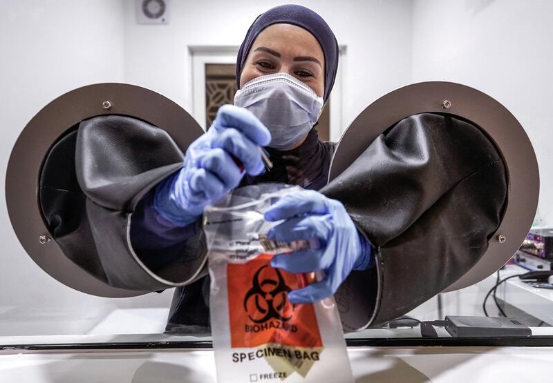 Abu Dhabi, United Arab Emirates, May 6, 2020. the new Ambulatory Healthcare Services, a SEHA Health System Facility, National Screening Project in Mussafah Industrial Area in Abu Dhabi.  --  A medical worker with a swab testing kit.
Victor Besa / The National
Section:  NA
Reporter:  Nick Webster