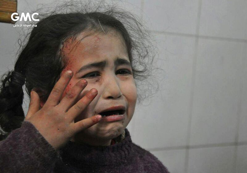 A Syrian girl who was wounded during airstrikes cries at a makeshift hospital in Ghouta. Ghouta Media Center via AP