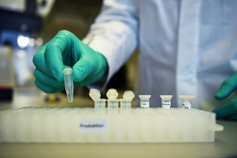FILE PHOTO: An employee of German biopharmaceutical company CureVac, demonstrates research workflow on a vaccine for the coronavirus (COVID-19) disease at a laboratory in Tuebingen, Germany, March 12, 2020. Picture taken on March 12, 2020. REUTERS/Andreas Gebert/File Photo