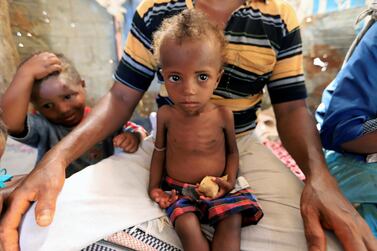 Hanaa Ahmad Ali Bahr, a malnourished girl sits on her father's lap in a shanty town in Hodeidah, Yemen March 25, 2019. Reuters