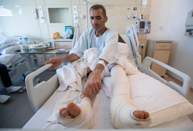 Ali Yosef Ramo, a Syrian earthquake survivor showing his injuries at Sheikh Shakbout Medical City, Abu Dhabi.  Leslie Pableo for The National