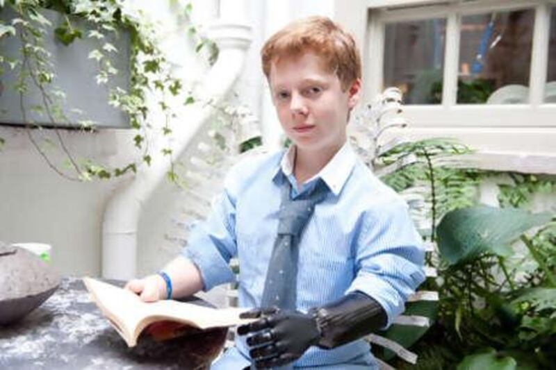 Patrick Kane, 13, is the youngest person to be fitted with a myoelectric, multiarticulating prosthesis - which his family simply calls his bionic hand. Like any science-fiction-crazy teenage boy, he enjoys showing it off.