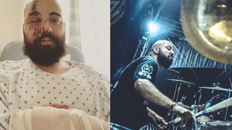 Drummer Bachir Ramadan is now recovering after being injured in the Beirut port explosion, but is keen to get back to performing again. Courtesy Nervecell