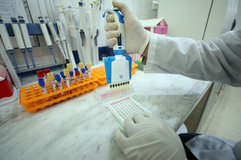 A Syrian doctor works at the EWARN laboratory set up for the early detection of coronavirus cases in rebel-held Idlib, in northwestern Syria, on March 25, 2020. - The virus is the latest threat to the three million people who live in Idlib, many of whom are now reduced to living in camps without basic amenities in Syria's last major rebel bastion, where a fragile truce has largely halted the government's bombardment since the start of the month. (Photo by OMAR HAJ KADOUR / AFP)