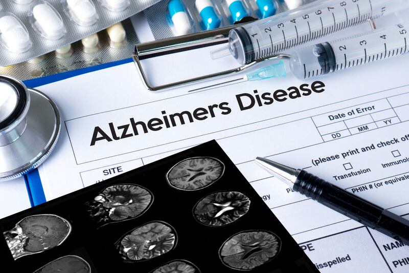 Brain scans showing Alzheimer's disease. Just Stock